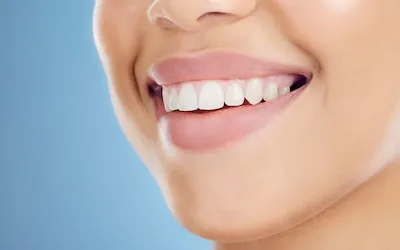 Blanqueamiento dental